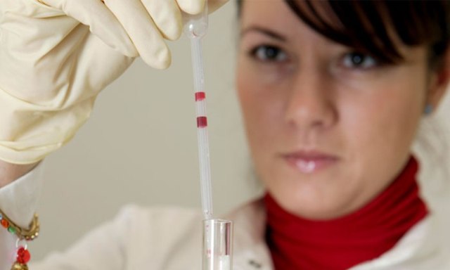 Ревмопроби: норми і розшифровка, як здавати аналіз крові на ревмопроби