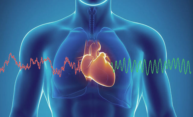 Прискорене серцебиття: причини, лікування, що робити при прискореному серцебитті