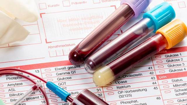 Аналіз крові на вітамін Д: підготовка до здачі, норми у жінок і чоловіків, для чого потрібен