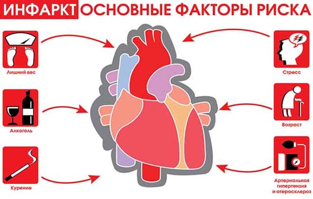 Атипові форми інфаркту міокарда: види, симптоматика, невідкладна допомога