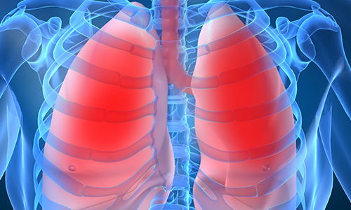 Пневмонія: симптоми, ознаки запалення легенів у дорослих, сучасні методи лікування