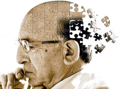 Хвороба Альцгеймера: симптоми і лікування, причини виникнення, діагностування та лікування Альцгеймера народними засобами.
