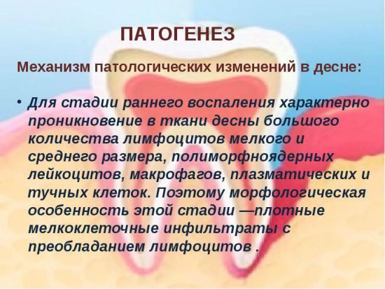 Гіпертрофічний гінгівіт: причини, симптоми, лікування, ознака набряку форми