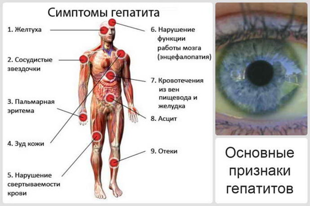 Географічний язик: причини виникнення у дорослого і дитини, лікування