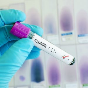 Аналізи крові на сифіліс: РИФ, ІФА, РВ, РІБТ, РПГА тест, ПЛР, розшифровка