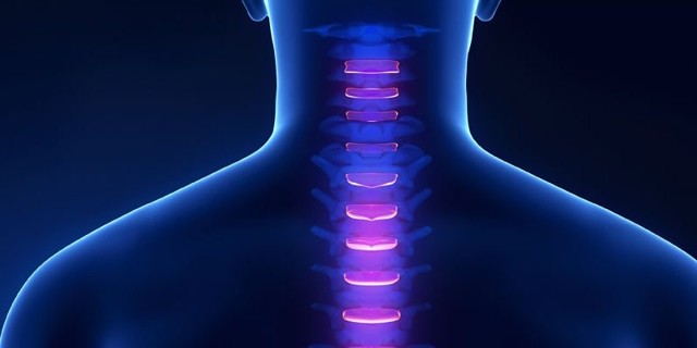 Що таке синдром хребетної артерії, симптоми і лікування при шийному остеохондрозі