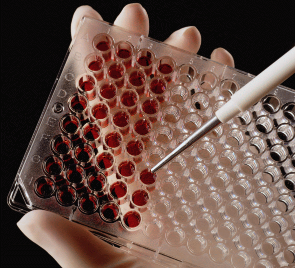 Аналіз крові на біохімію: в якому разі проводиться, розшифровка біохімічного аналізу крові, трактування результатів
