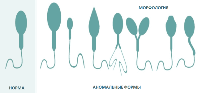 Морфологія сперматозоїдів: як виглядають нормальні сперматозоїди і спермограма