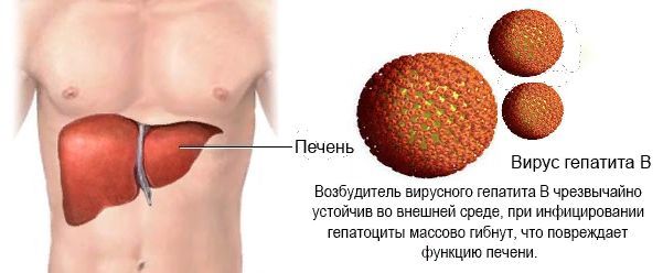 Вірусний гепатит b: лікування, як передається, симптоми гепатиту b, аналіз на гепатит