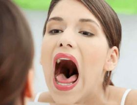 Неприємний запах з рота: причини появи, ефективні методи боротьби з галітозом
