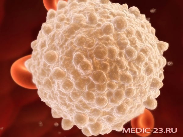 Чому підвищені лейкоцити в крові: причини і лікування