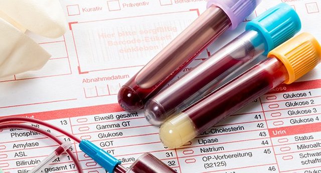Аналіз крові на цукор: як перевірити цукор крові, розшифровка результатів аналізу крові на цукор 
