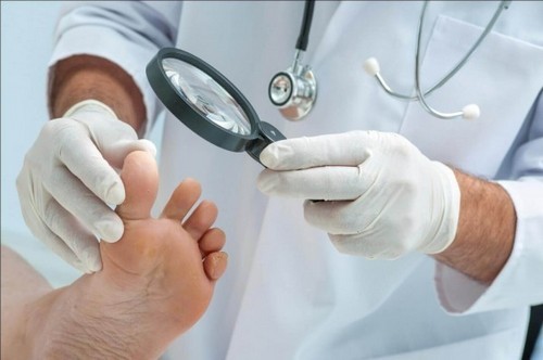 Лікування запущеного грибка нігтів: ефективні засоби лікування грибка нігтів запущеної форми