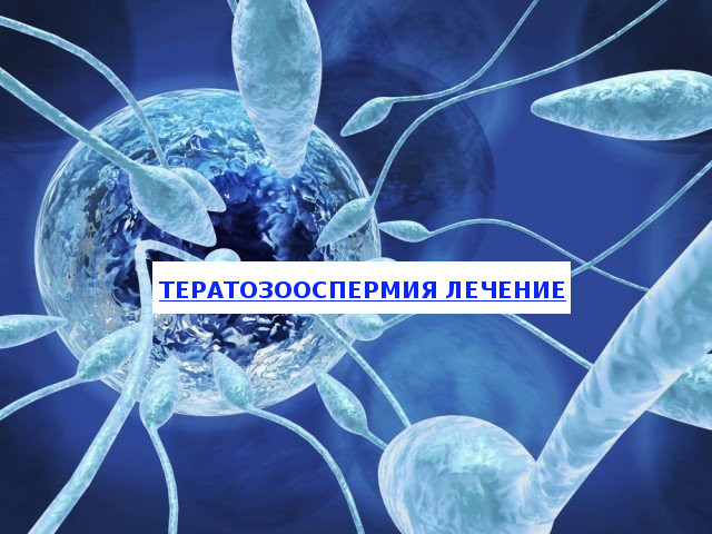 Тератоспермія: що це таке, причини і лікування тератосперміі