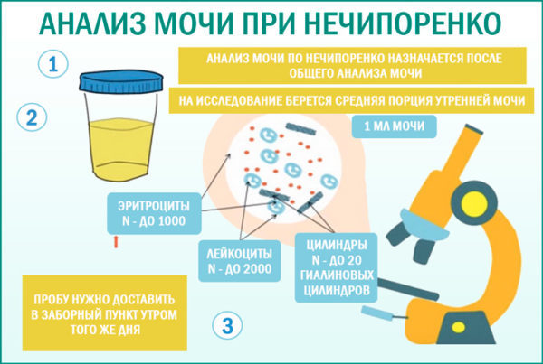 Аналіз сечі по Нечипоренко: як збирати, що показує, норми у жінок, дітей і чоловіків