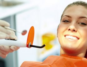 Які пломби краще ставити на жувальні і передні зуби: порівняння пластмасових і светоотверждаємих матеріалів