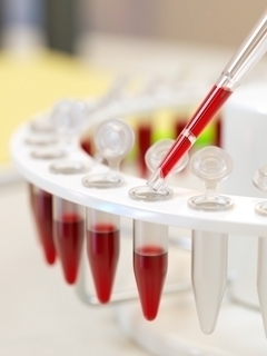 Як розшифрувати загальний аналіз крові та аналіз крові на гормони щитовидної залози: відхилення від норми в аналізах крові