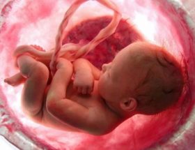 Амниотический тяж при вагітності: причини виникнення, методики лікування, наслідки для дитини
