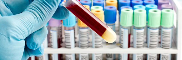 Як розшифрувати дані аналізу крові та імунограми