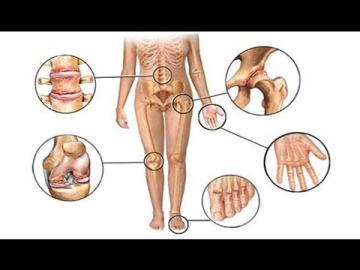 Народні засоби від болю в суглобах: для внутрішнього і зовнішнього застосування