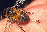 Укуси жалких комах у дітей - оси, бджоли, джмелі, шершні, чим небезпечні, як проявляються, що робити для зменшення свербежу та почервоніння, біль
