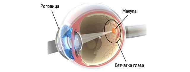 Макулодистрофія сітківки ока: причини, лікування, профілактика