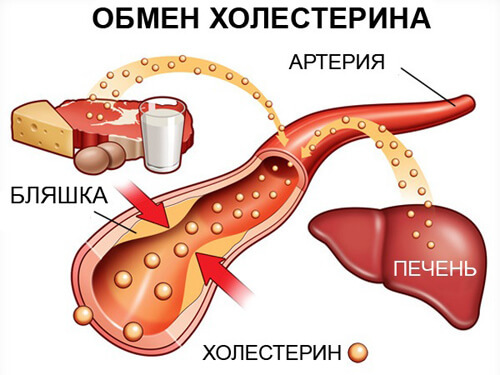 Методи очищення судин від холестерину, атеросклеротичних бляшок і тромбів