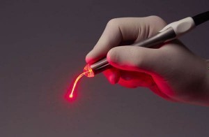 Обрізання лазером - циркумцизия або лазерне видалення крайньої плоті у чоловіків