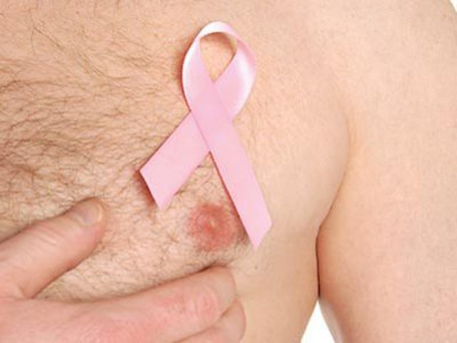 Рак грудей у ​​чоловіків: симптоми, причини розвитку, способи діагностики та лікування