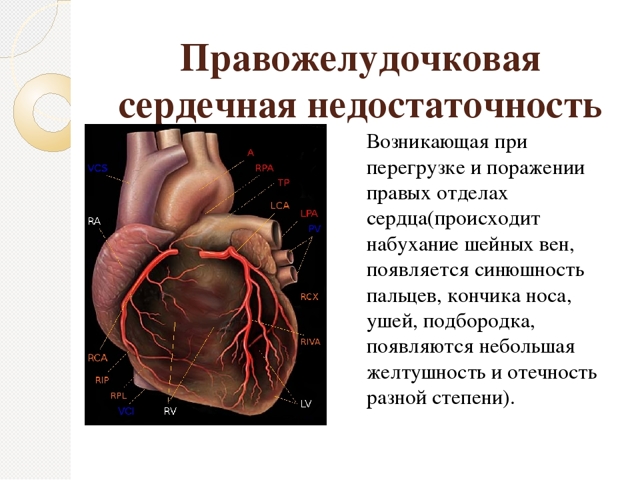 Симптоми серцевої недостатності (гострої, хронічної і застійної)