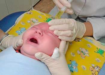 Зондування слізного каналу у новонароджених і дітей до року: відео, наслідки, відгуки, як роблять